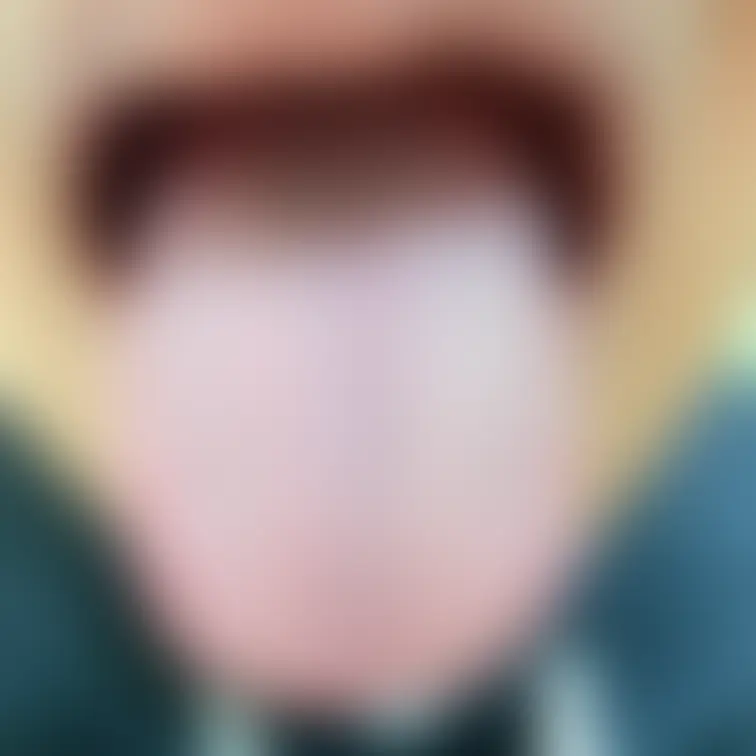 舌76