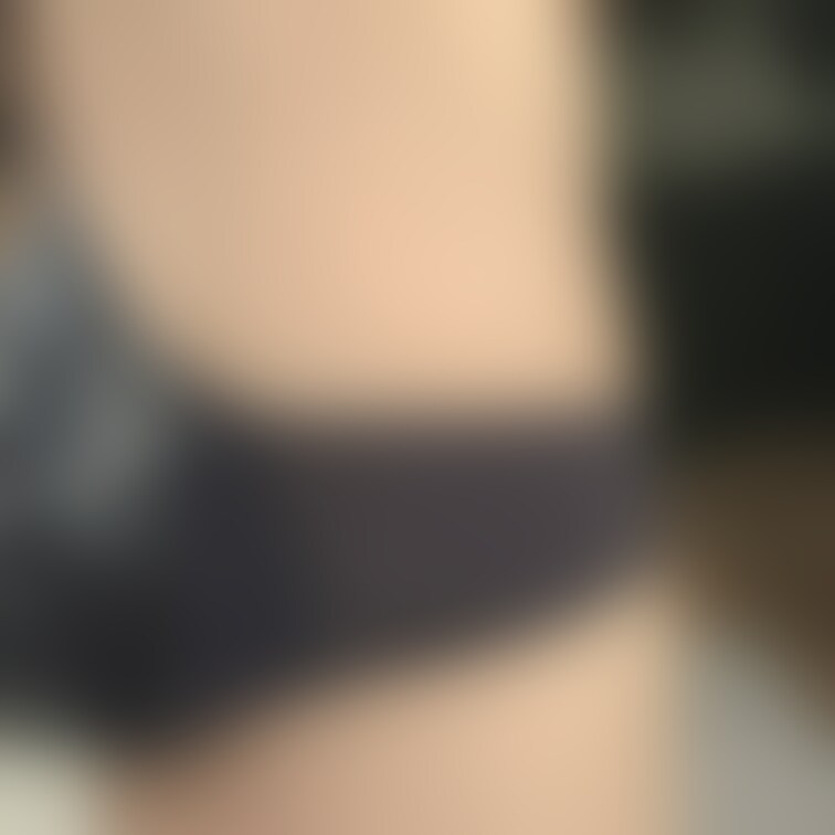 脇は恥ずかしいからやめてーーのポーズ