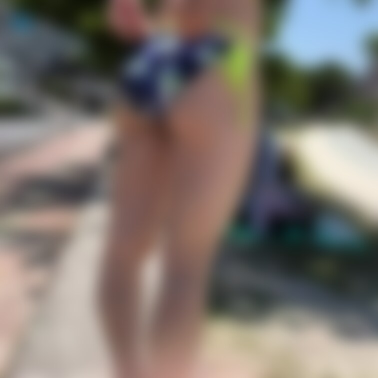 日焼けビフォーアフター😎