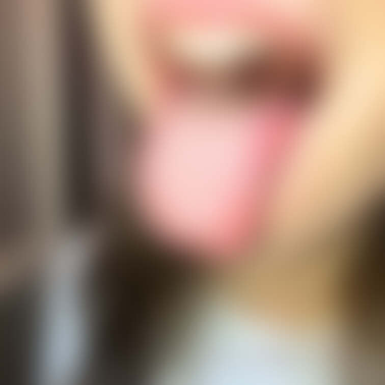 舌41