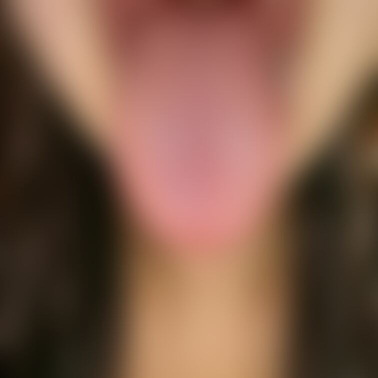 舌1