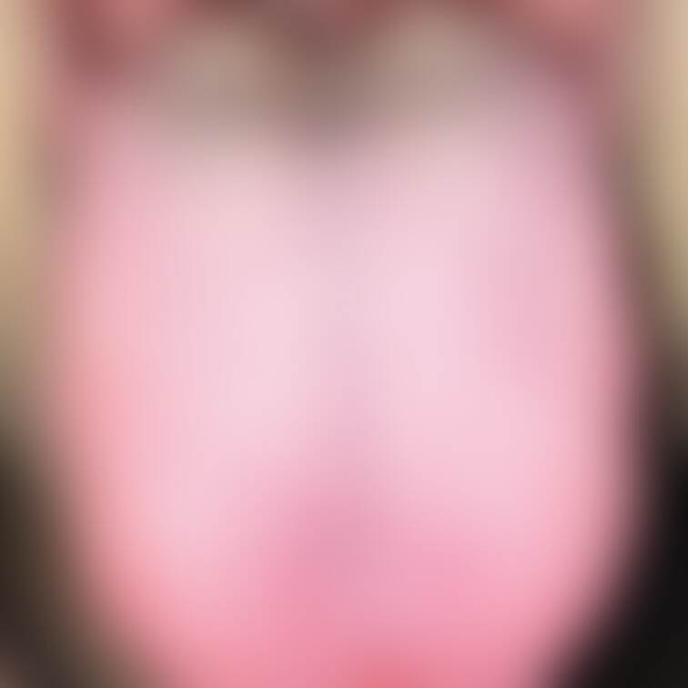 舌3
