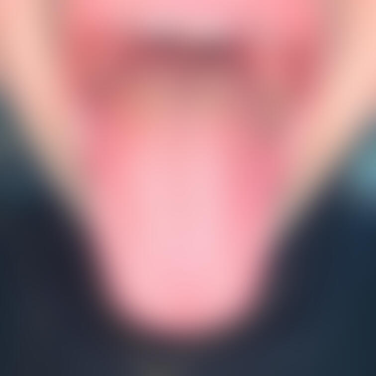 舌35