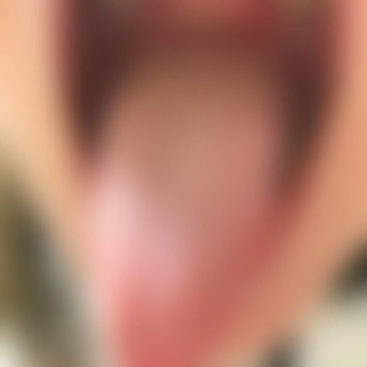 舌9
