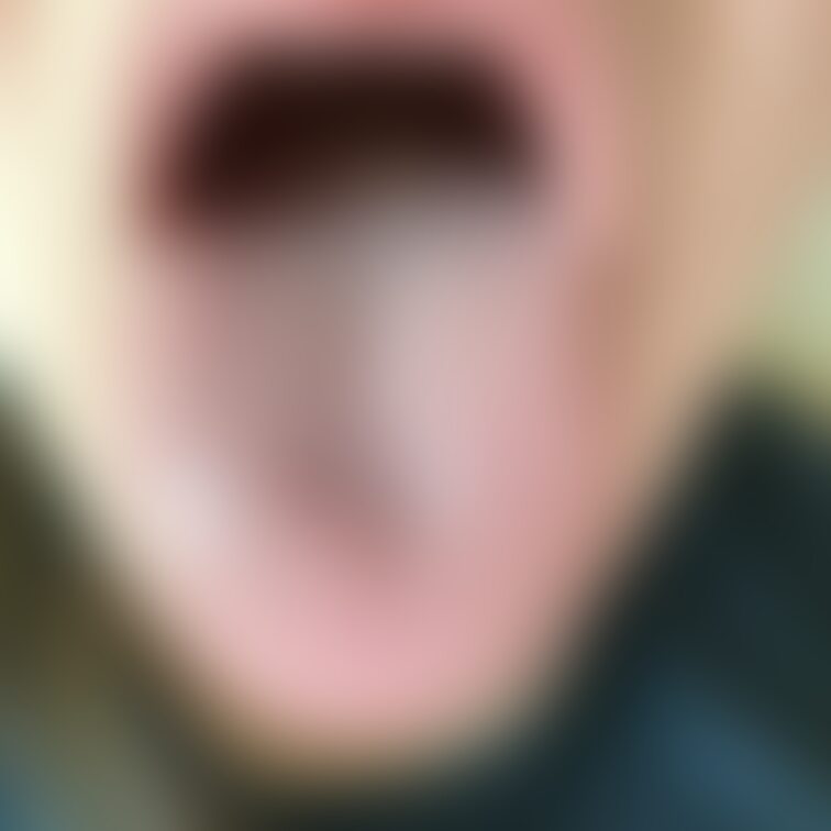 舌16