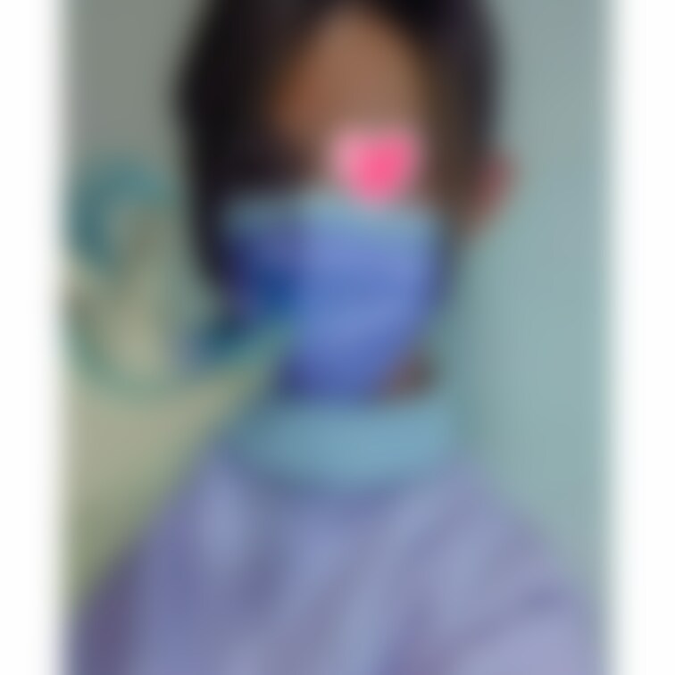 開口器だよ