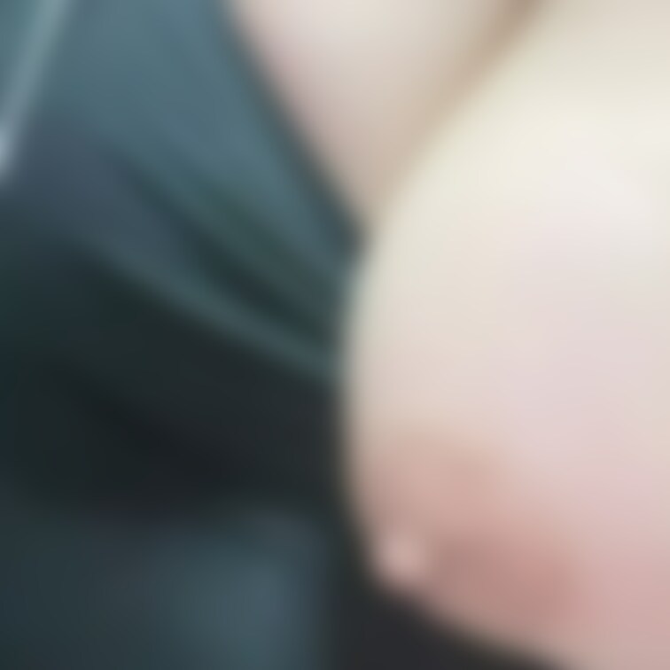 おっぱいにあとついとる笑