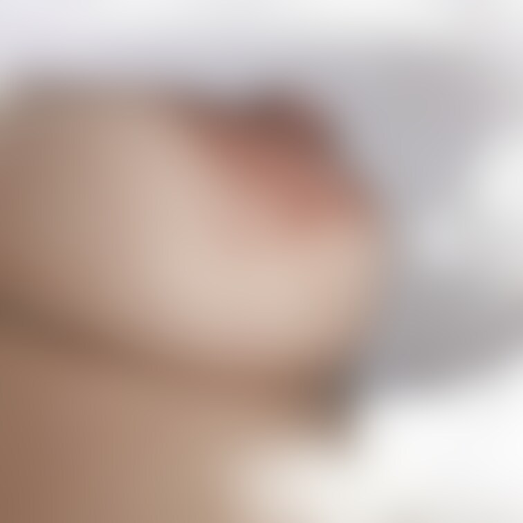 おっぱいにホクロがあるの