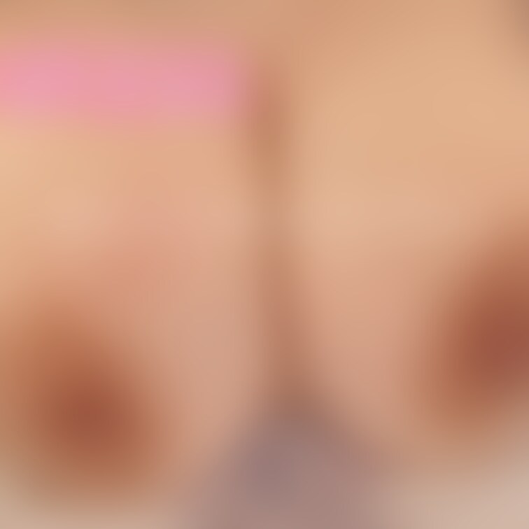 2025.03.22
あっつくてひっかいちゃった笑