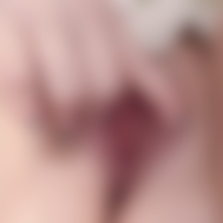 くぱ