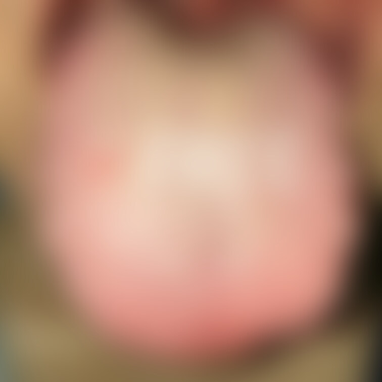 舌写真