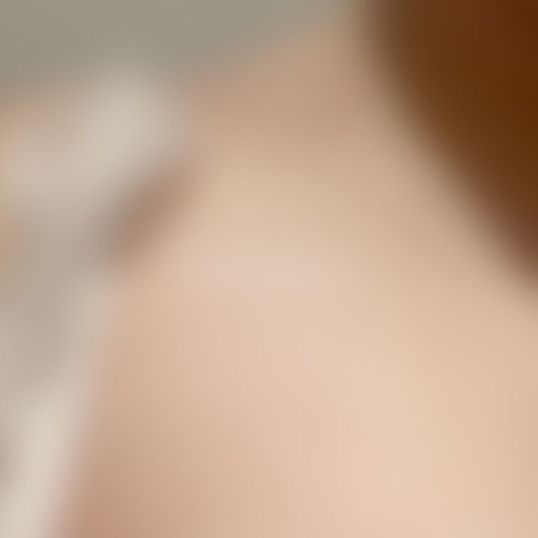 優しい噛み跡はすぐ消えちゃうんだ。
でも見えてる時間、大切に大事に触って痛みを 跡を確認して幸せを感じるんだ。