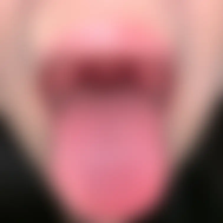 舌78