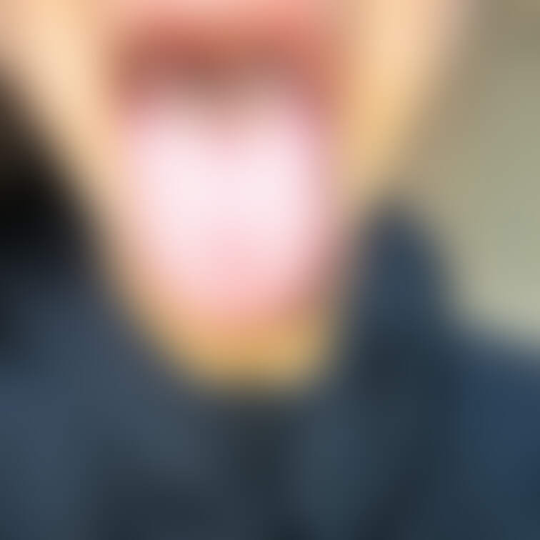 舌42