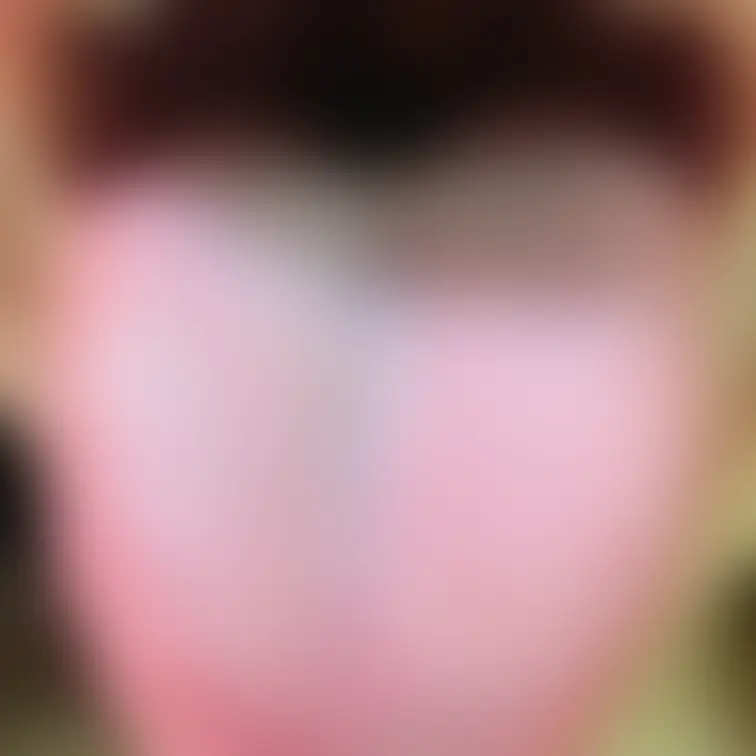 舌73