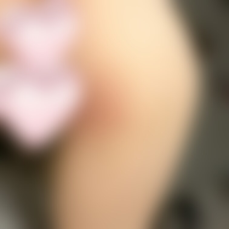 噛み跡をおすそわけ😌💖