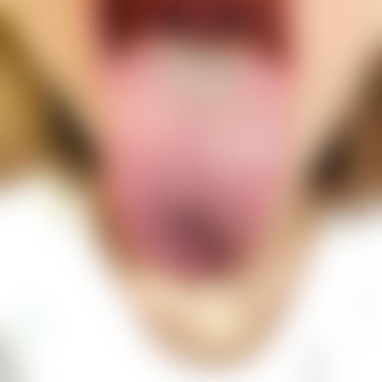 舌27