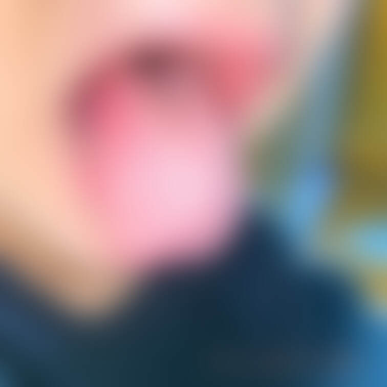 舌28　secret