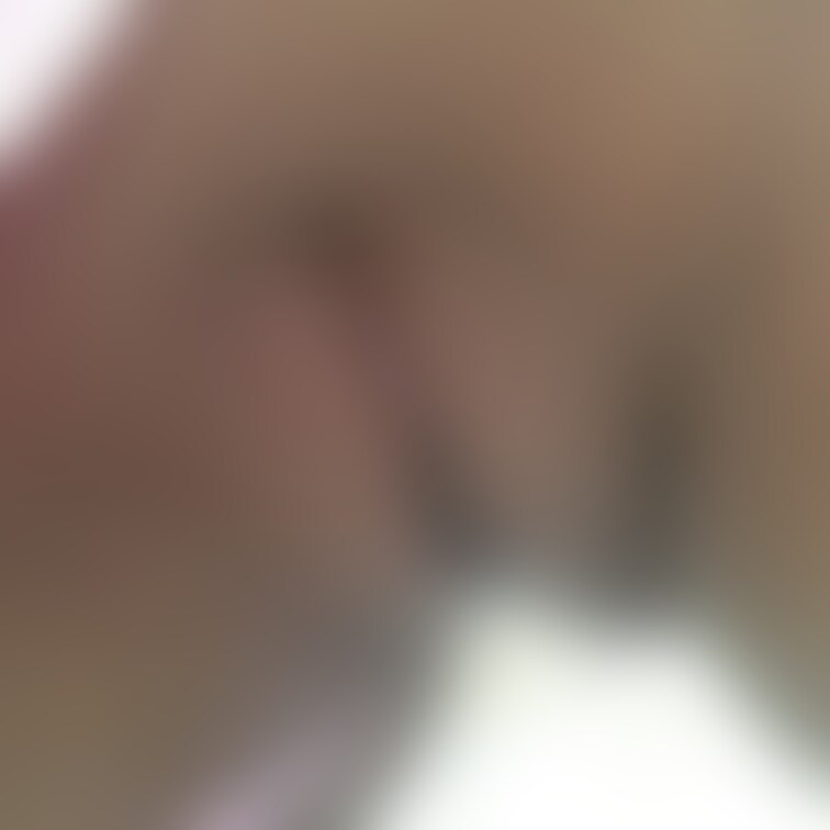 極小水着の丸見えおまんこ＆びんびん乳首です。