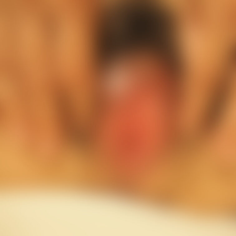 パイパンのビフォーアフター再掲。モザイクが薄かったのかな？削除されてました。
