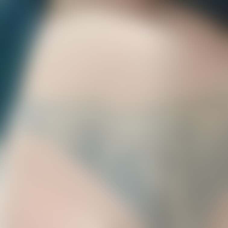 差分