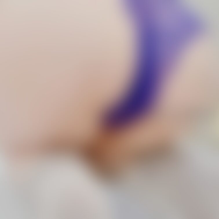 寒いからモコモコ靴下を履き始めました🥰
女子は冷やしちゃダメだからね☺️

お尻にブツブツ出来ちゃった🥺
ニキビ