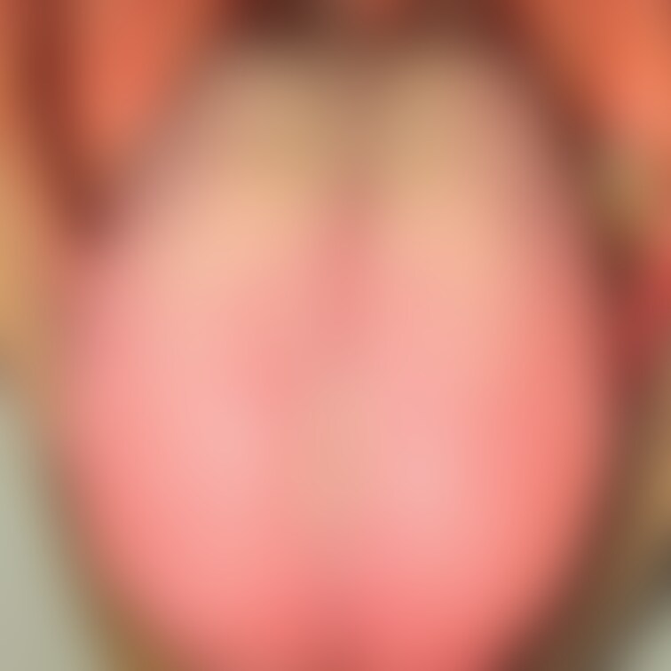 舌8