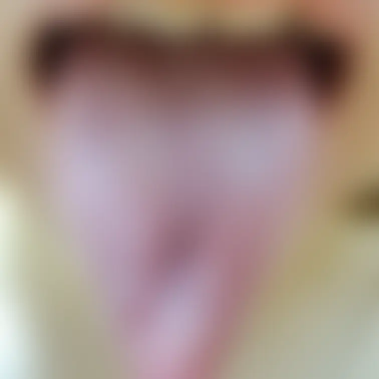 舌77