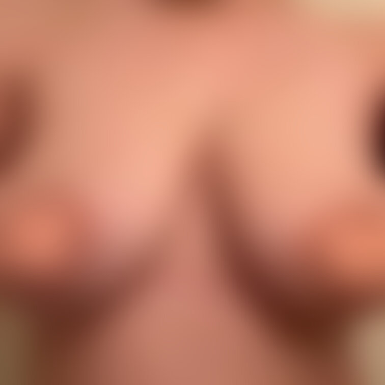 乳輪