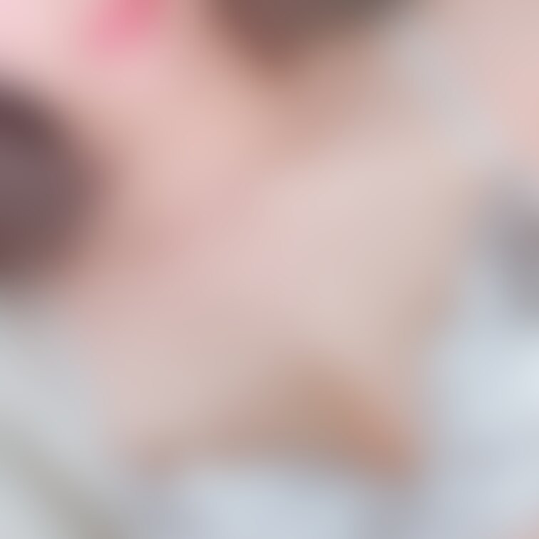 差分