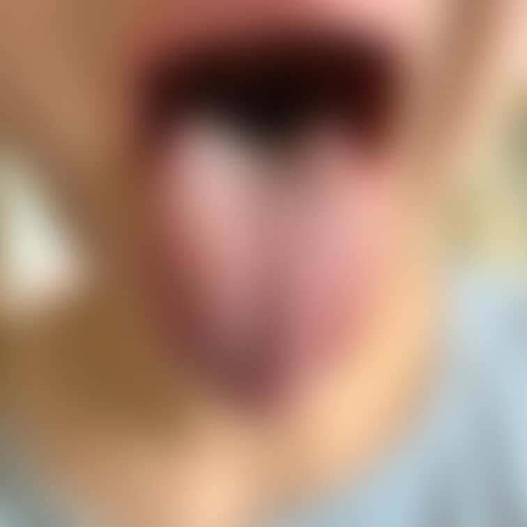 舌33
