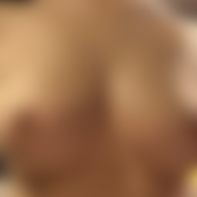 一枚目術前
二枚目いま
ぼかしなしはこちら
https://myfans.jp/posts/ea80○○○3-
