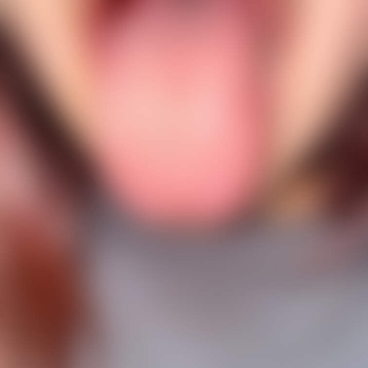 舌31