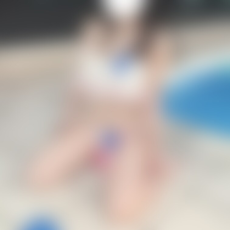 前に例のプールいってきた時の！
腕のアザが🫣