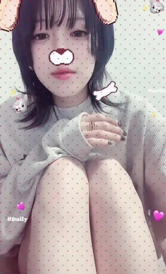 ねむ🐈‍⬛「生足フェチに刺され～︎^_^」の投稿サムネイル