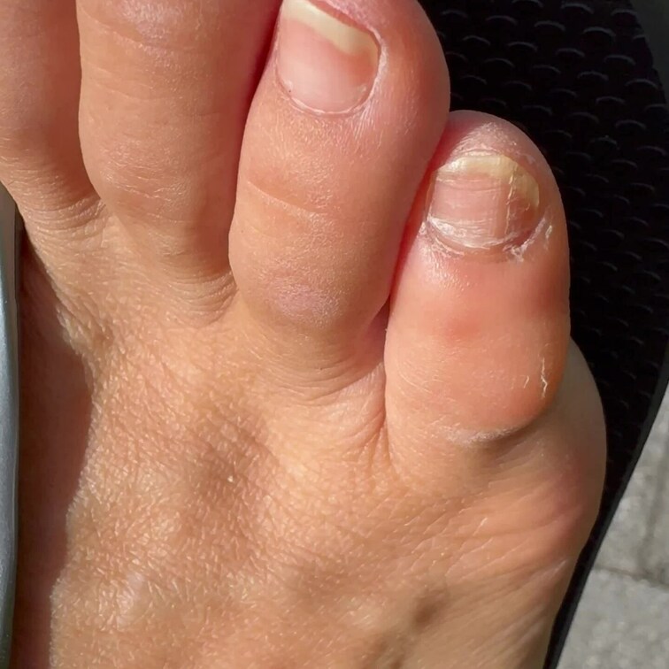 ちょっと乾燥気味のつま先ドアップ