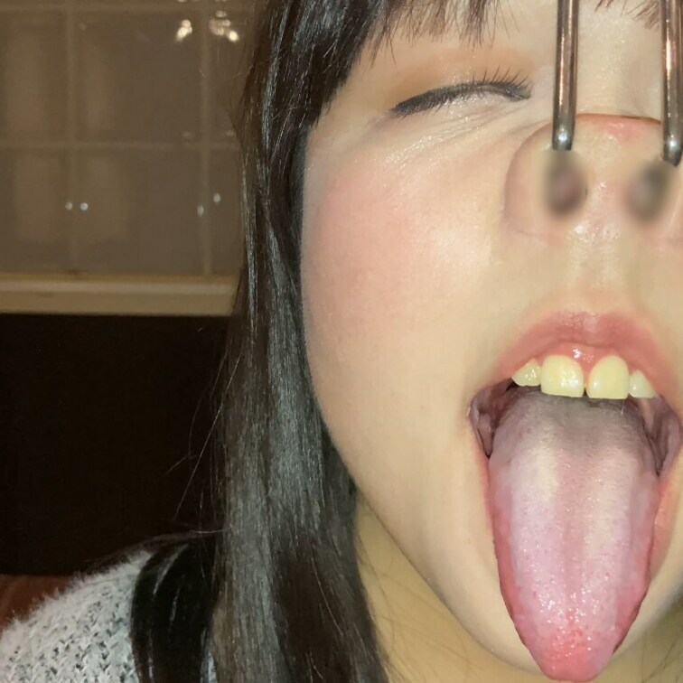 鼻フック、三方向鼻フック、鼻責め、顔責め、白目、豚鼻、鼻くそ、鼻毛観察、開口器、鼻フックペットボトルPART2【美月26