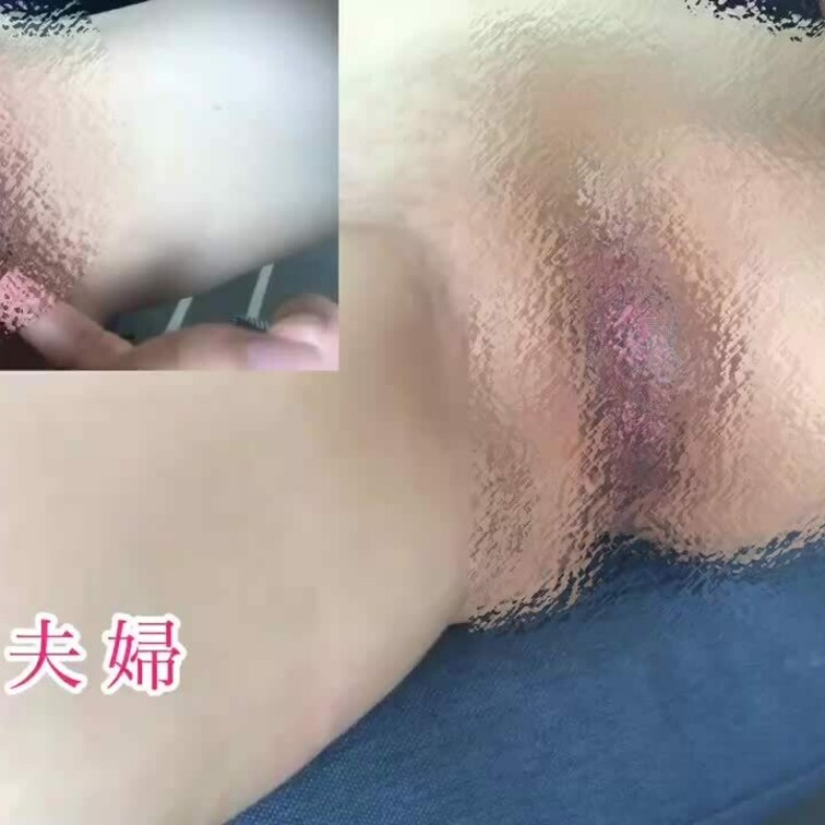 クンニ💕
妻のアソコ指入れ🤌
