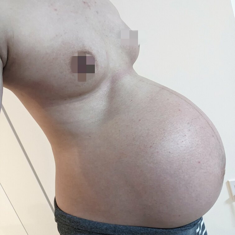 34w6d

お久しぶりの投稿です🤣
スマホが壊れてデータがすべてなくなり、
全然ログインできていませんでした😂