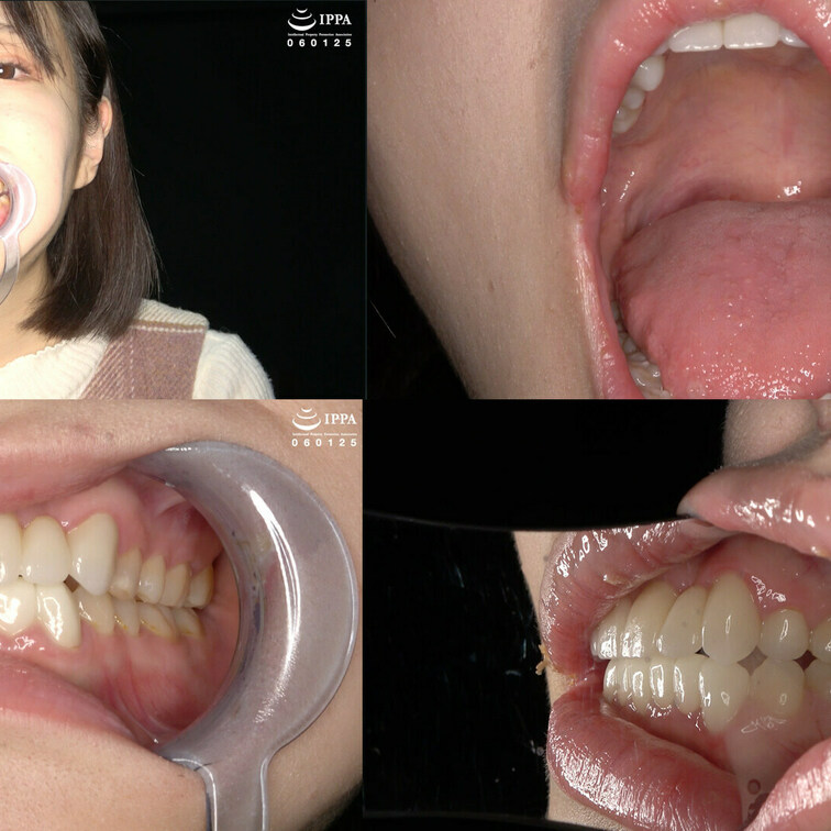 【人気女優 琥珀ややチャンの超貴重な歯・口内・のどちんこ観察＆咀嚼】ADOA-085 琥珀やや HD Ver.

人