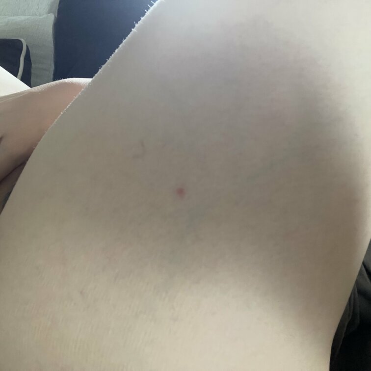 ホテルで刺された…🥺