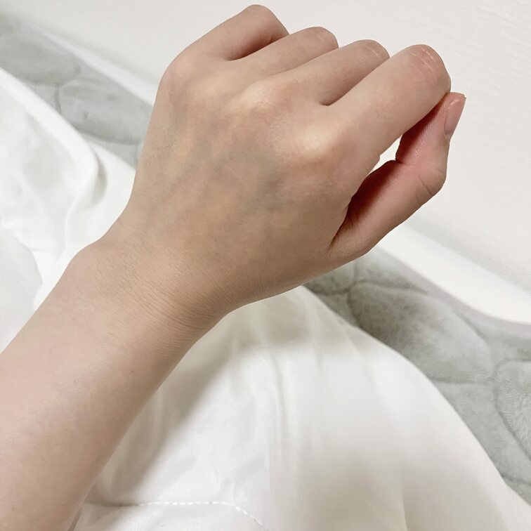 血管フェチに刺され𓂃◌𓈒𖡼𓂂