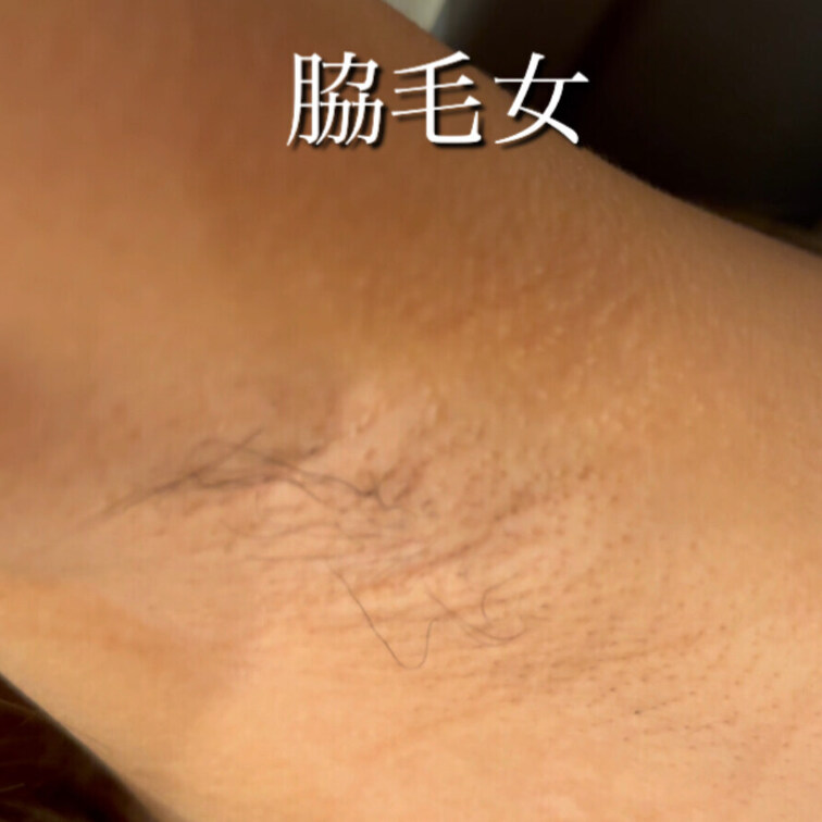 パイパン脇毛女💕