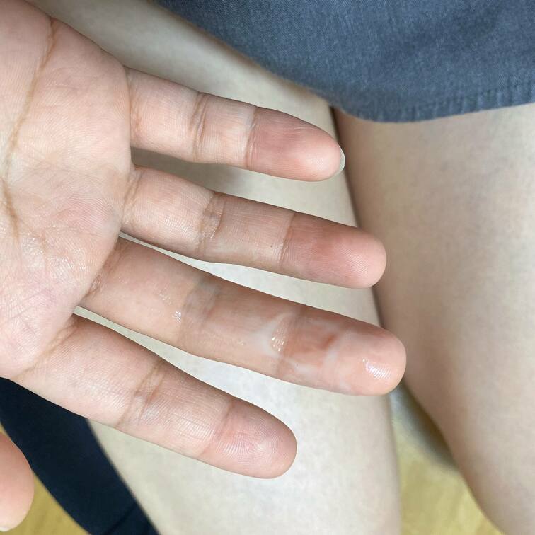 最近の悩みはえっちすると不正出血すること🥺

止まってるみたいだけど下着はちょっと赤いんだよね😔