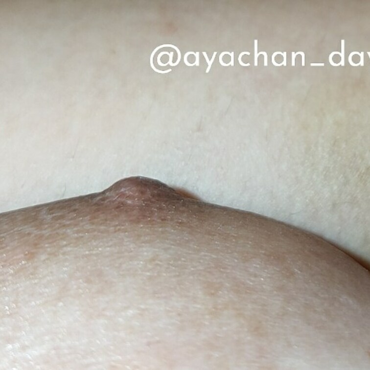 気が付いたら腕に青アザ出来てました!😭
いつぶつけたか分からない!(笑)
毛も剃らなきゃなぁ~