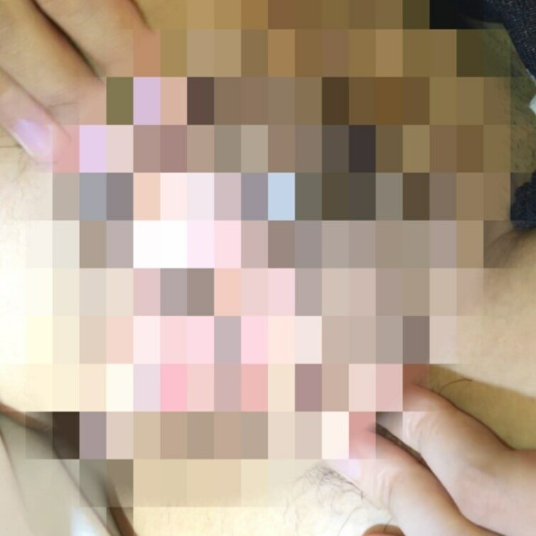 【華のNo.SEVENTEENちゃん】おまんこのドアップです〜幼な顔なのにあそこ周りはすっごく卑猥な美少女です❤️有料会