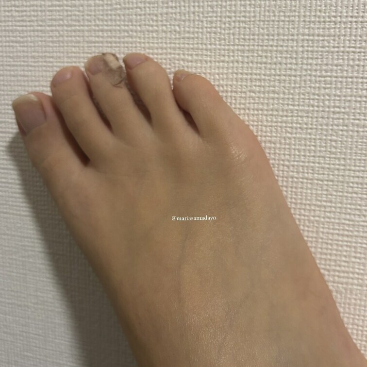 爪が伸びてて痛くて絆創膏貼って
仕事したらくしゃくしゃなってた☺️💦
絆創膏にまで臭い染み付いてる。くっさ