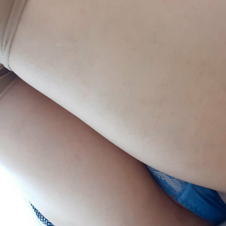 絶対領域だよ🥺💕
