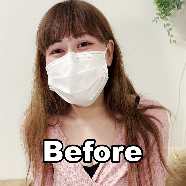 #43【MIZUKI 25歳】SAMPLE
※続きはVIPプラン加入or単品販売にてご視聴いただけます。（着替え、施術