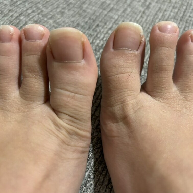 足臭ナースの足先🦶💖